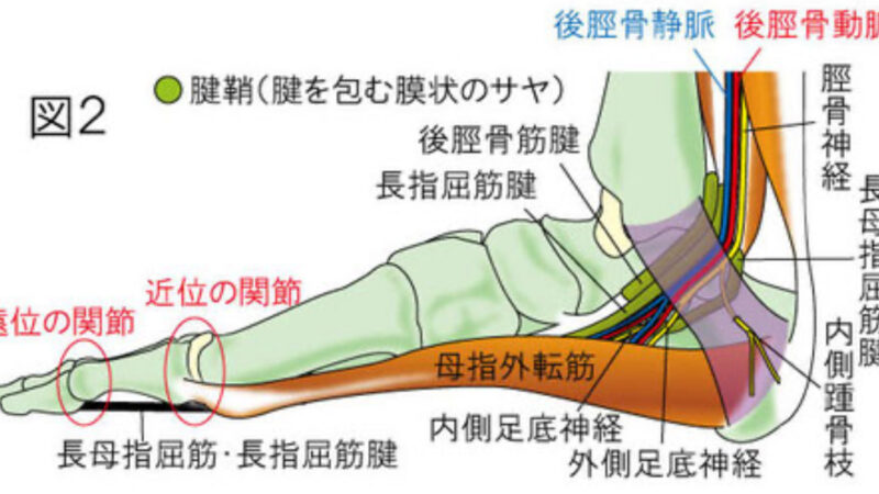 足根管症候群