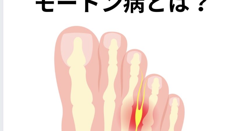 モートン病とは？