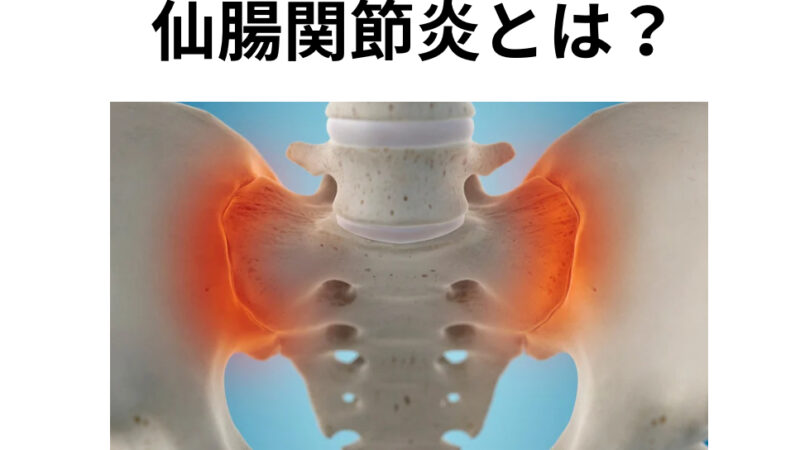 仙腸関節炎とは？
