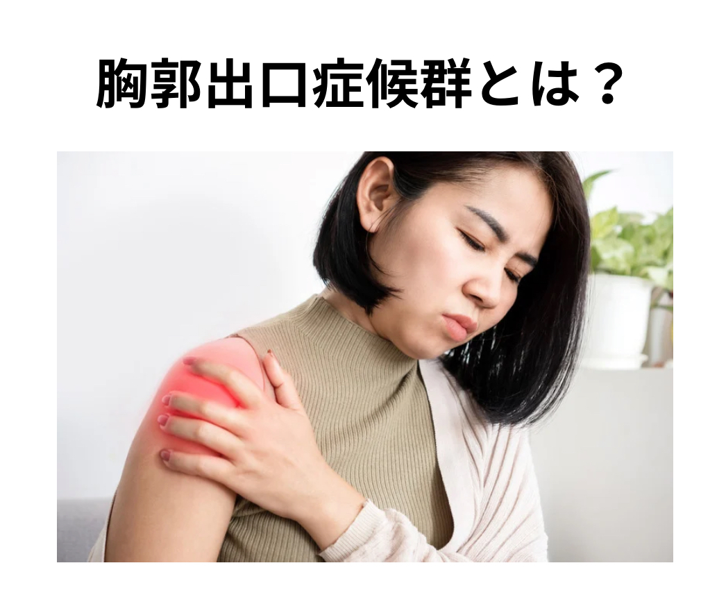 胸郭出口症候群とは?