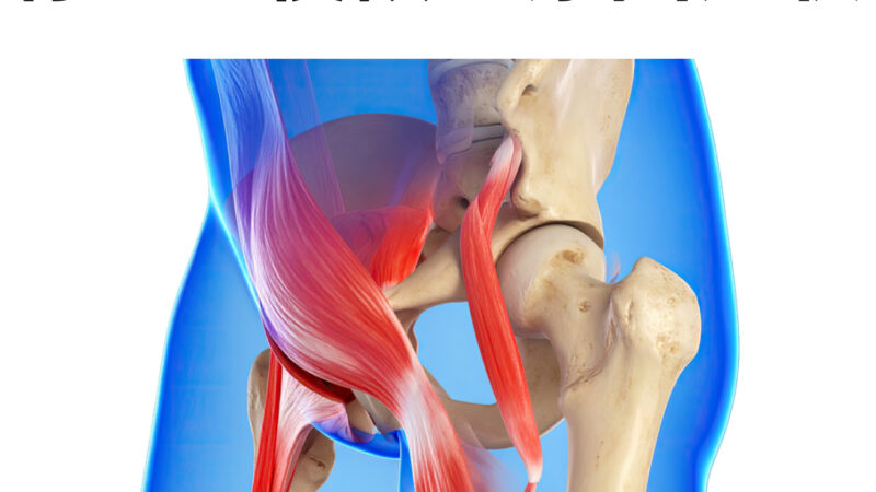 骨盤後傾の原因と症状